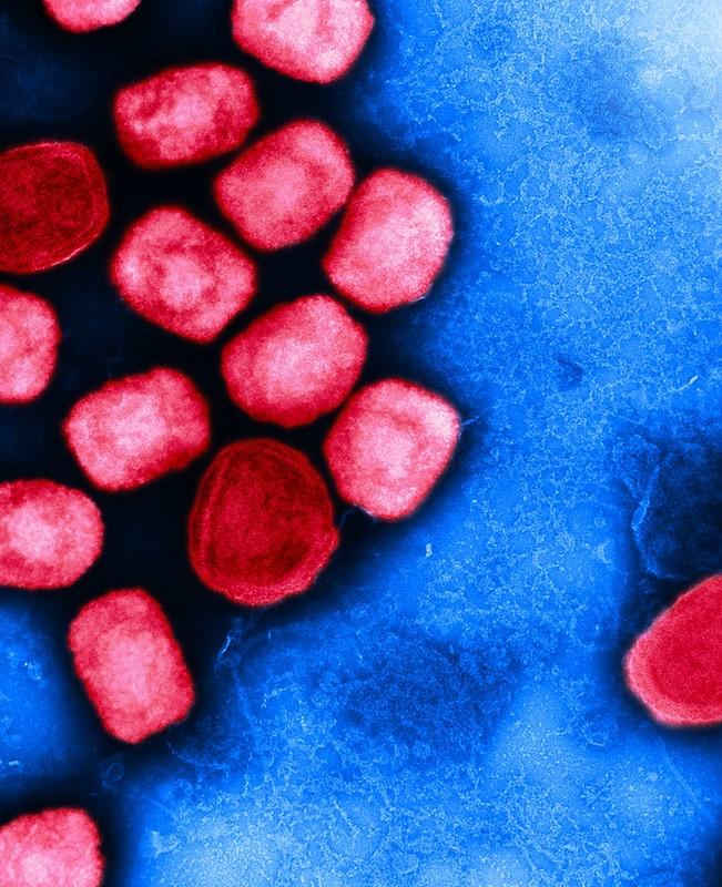 Red mpox viruses