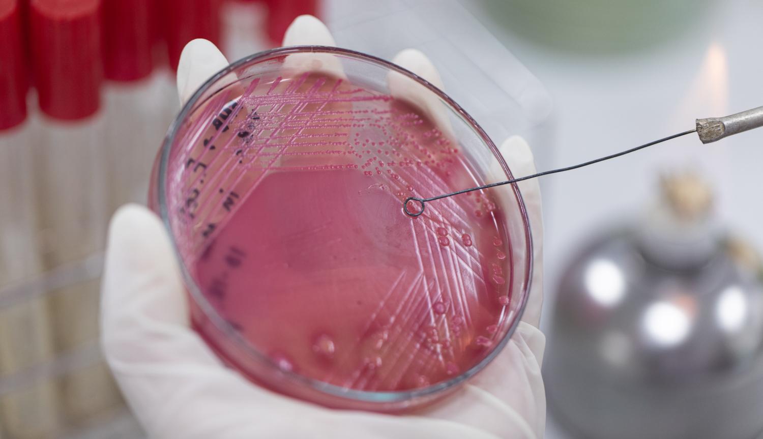 Streak plate for bacterial culture