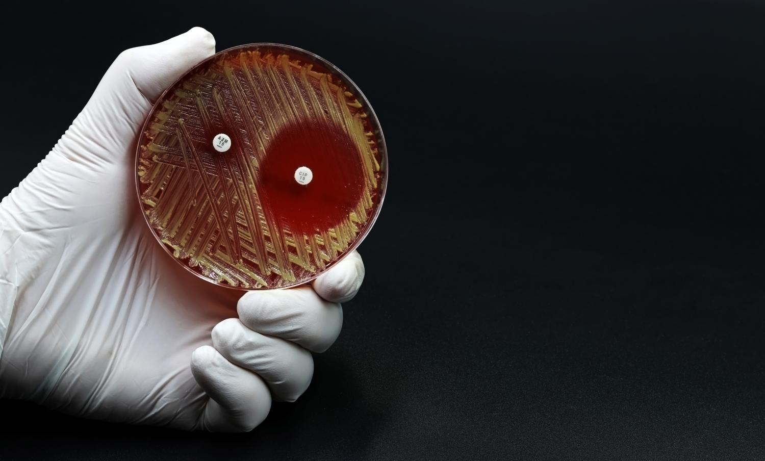 Drug-resistant bacteria in petri dish