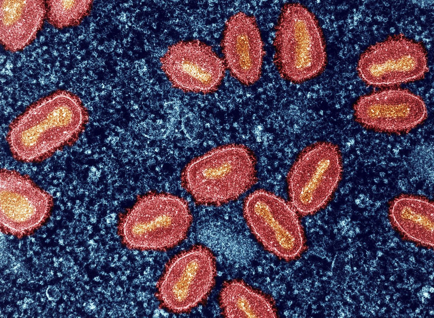 mpox micrograph