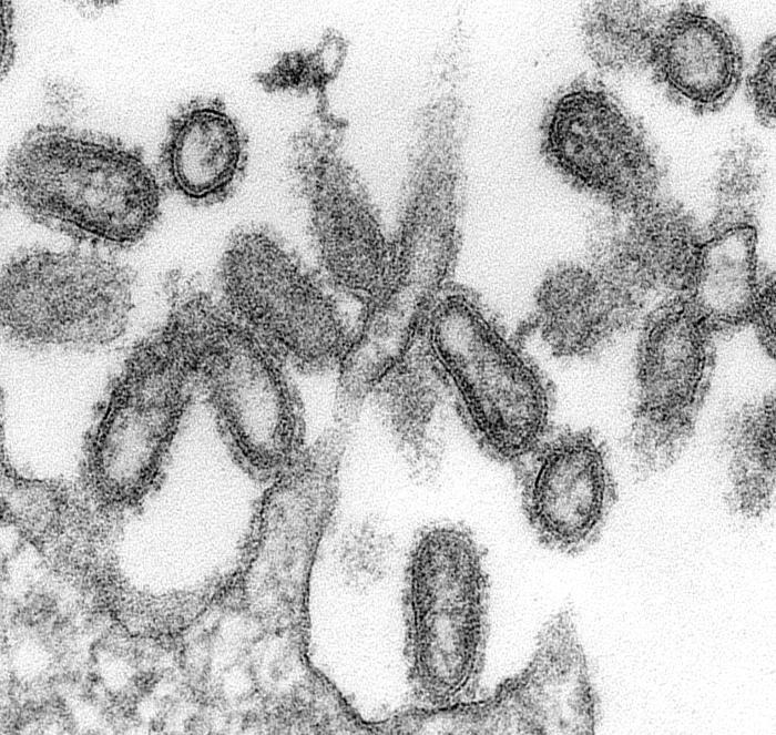 1918 influenza virus