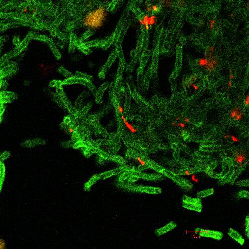 Bacillus anthracis micrograph