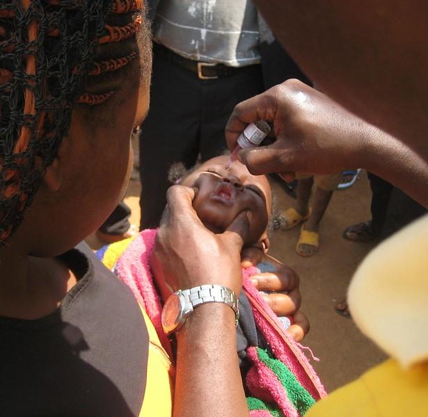 Baby receiving oral polio vaccine