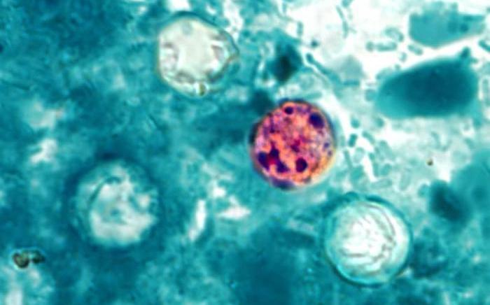 Micrograph of Cyclospora oocysts in stool sample