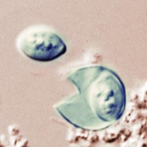 Rupturing Cyclospora oocyst viewed under microscope