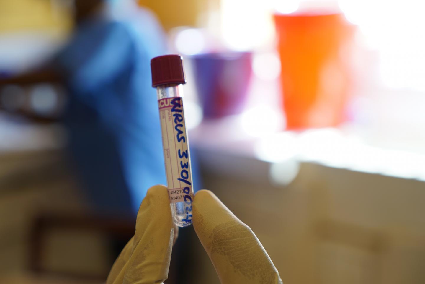 Ebola blood vial
