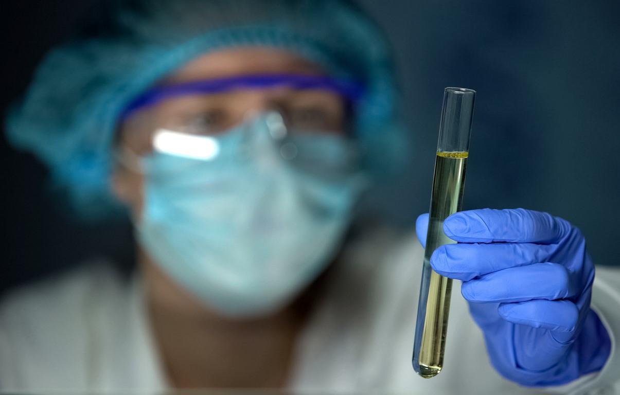 Scientist with urine in test tube