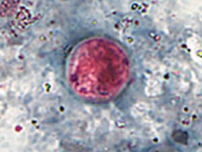 Cyclospora oocysts
