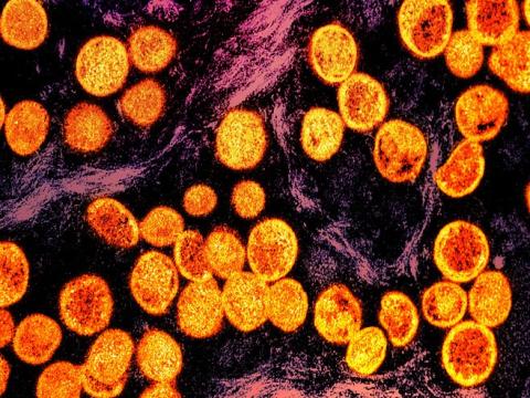 Micrograph of mpox viruses