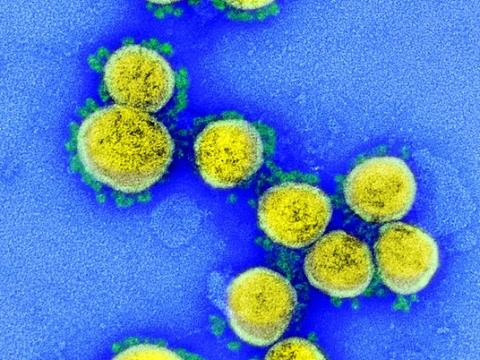 SARS-Cov-2 viruses under microscope