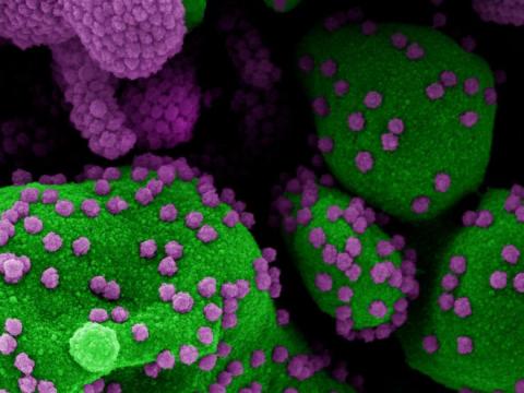 SARS-CoV-2 viruses under microscope