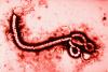 Ebola virus highly magnified