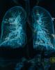 Lung imaging