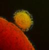Transmission electron micrograph of Middle East Respiratory Syndrome Coronavirus
