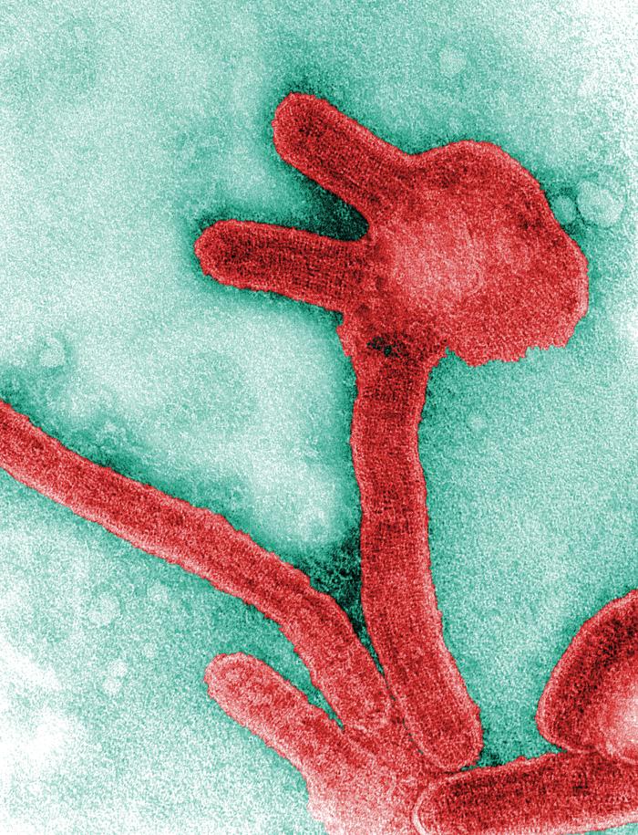 Marburg virus under the microscope