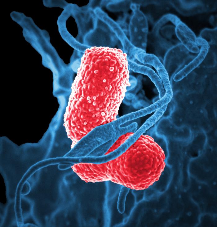 Klebsiella pneumoniae