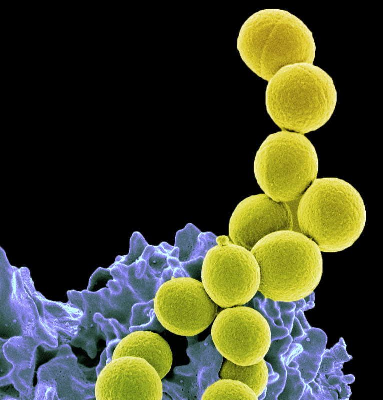 Methicillin-resistant Staphylococcus aureus