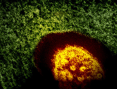 measles virus