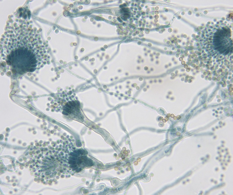 Aspergillus fumigatus