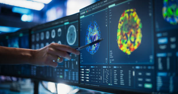 Brain MRI