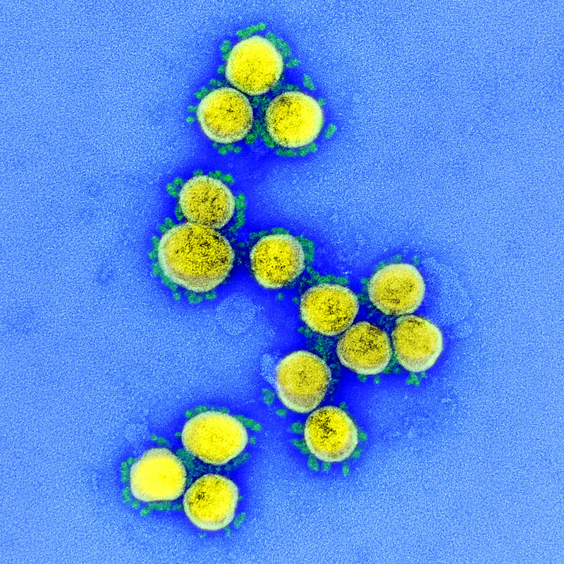 SARS-CoV-2