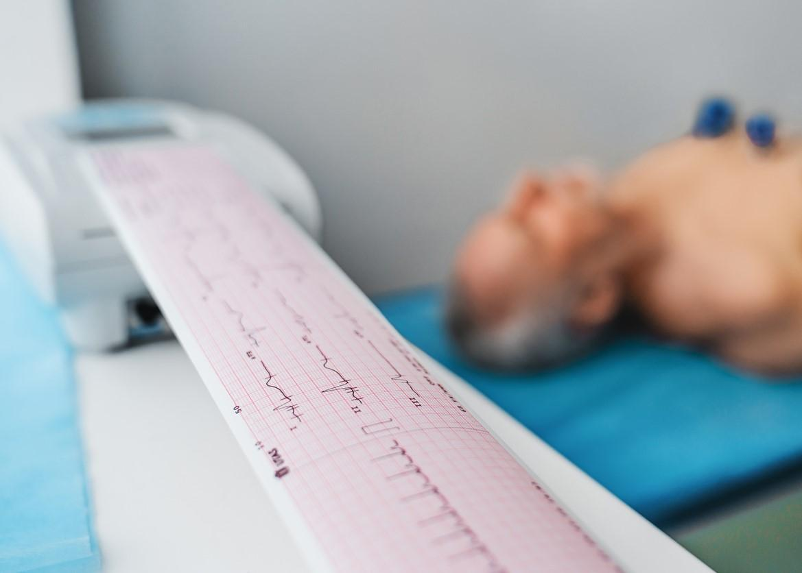 Man lying on stretcher undergoing EKG