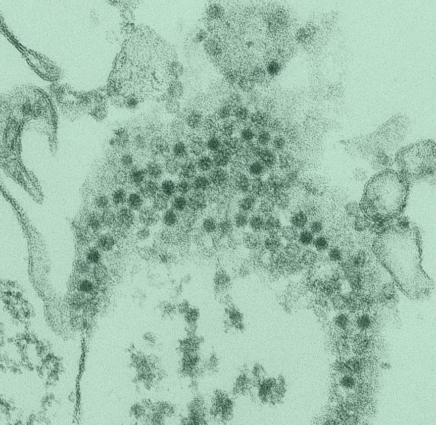 EV-D68 enteroviruses