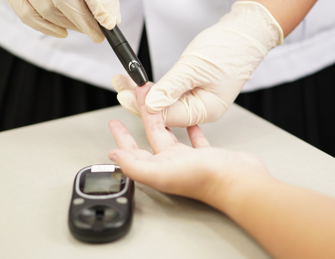 Finger prick for monitoring blood glucos