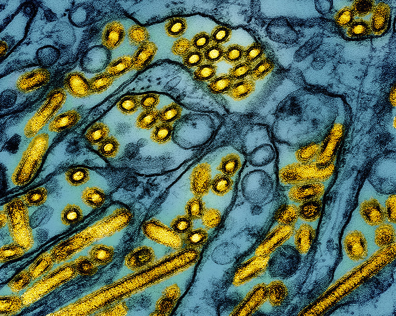 H5N1 blue gold