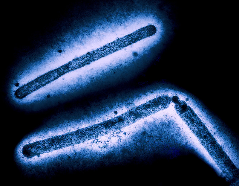 H5N1 micrograph