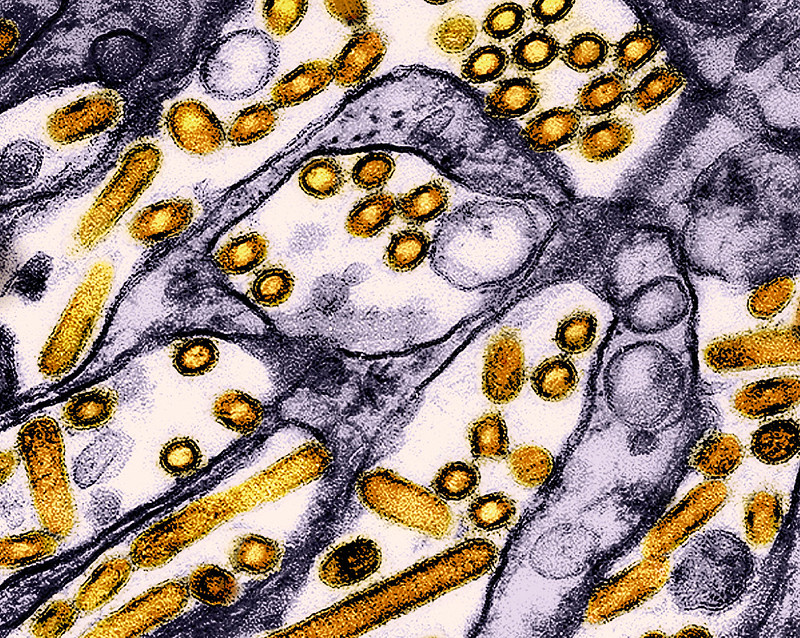 H5N1 purple brown