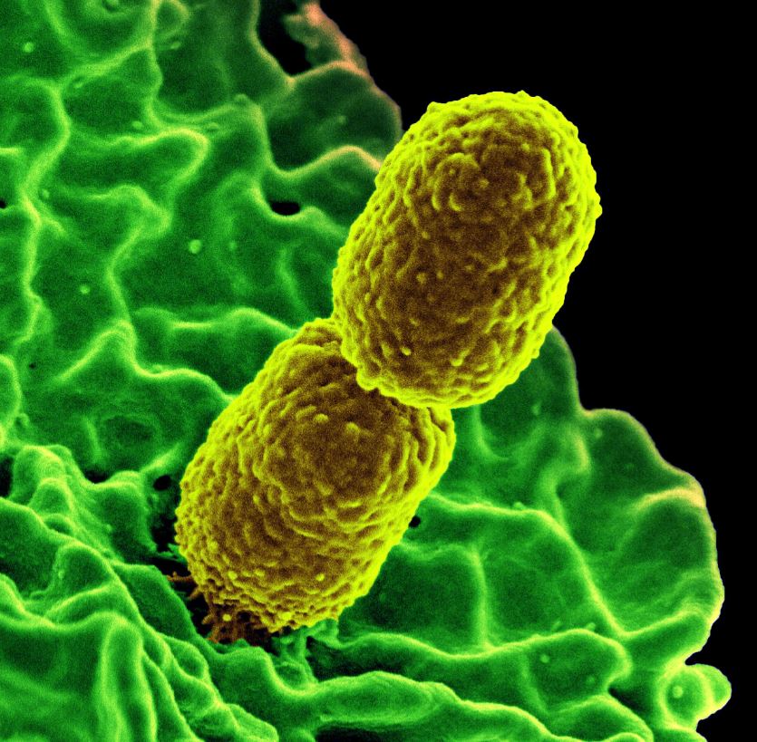 Klebsiella pneumoniae