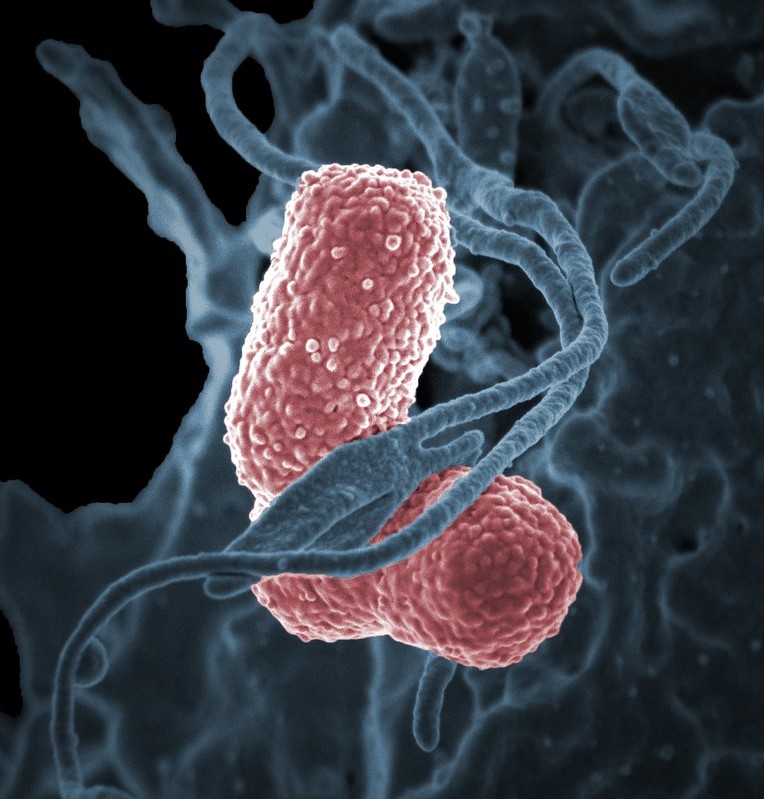 Klebsiella pneumonia bacteria