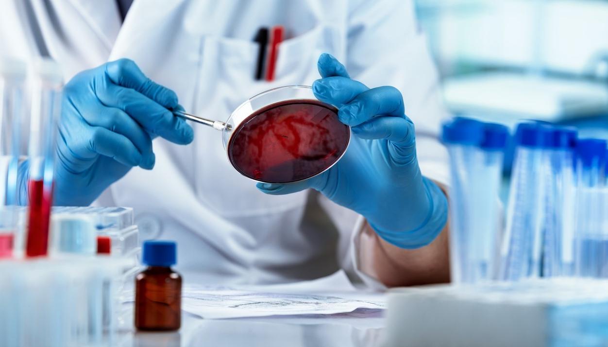 Scientist examining blood culture