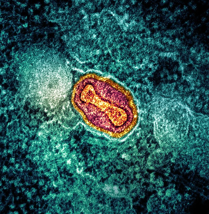 Mpox virus