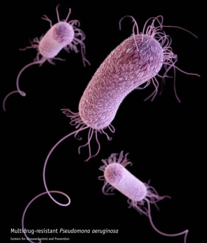 Multidrug-resistant Pseudomonas aeruginosa