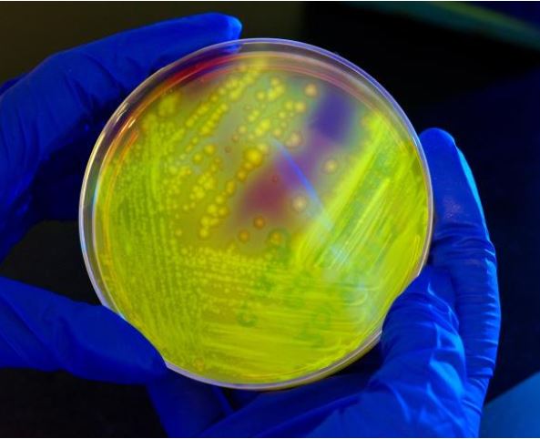 MRSA in petri dish