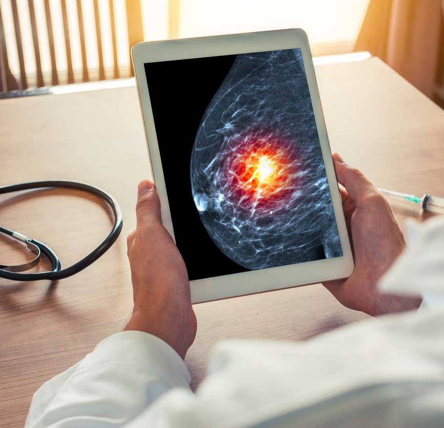 Mammogram on handheld device
