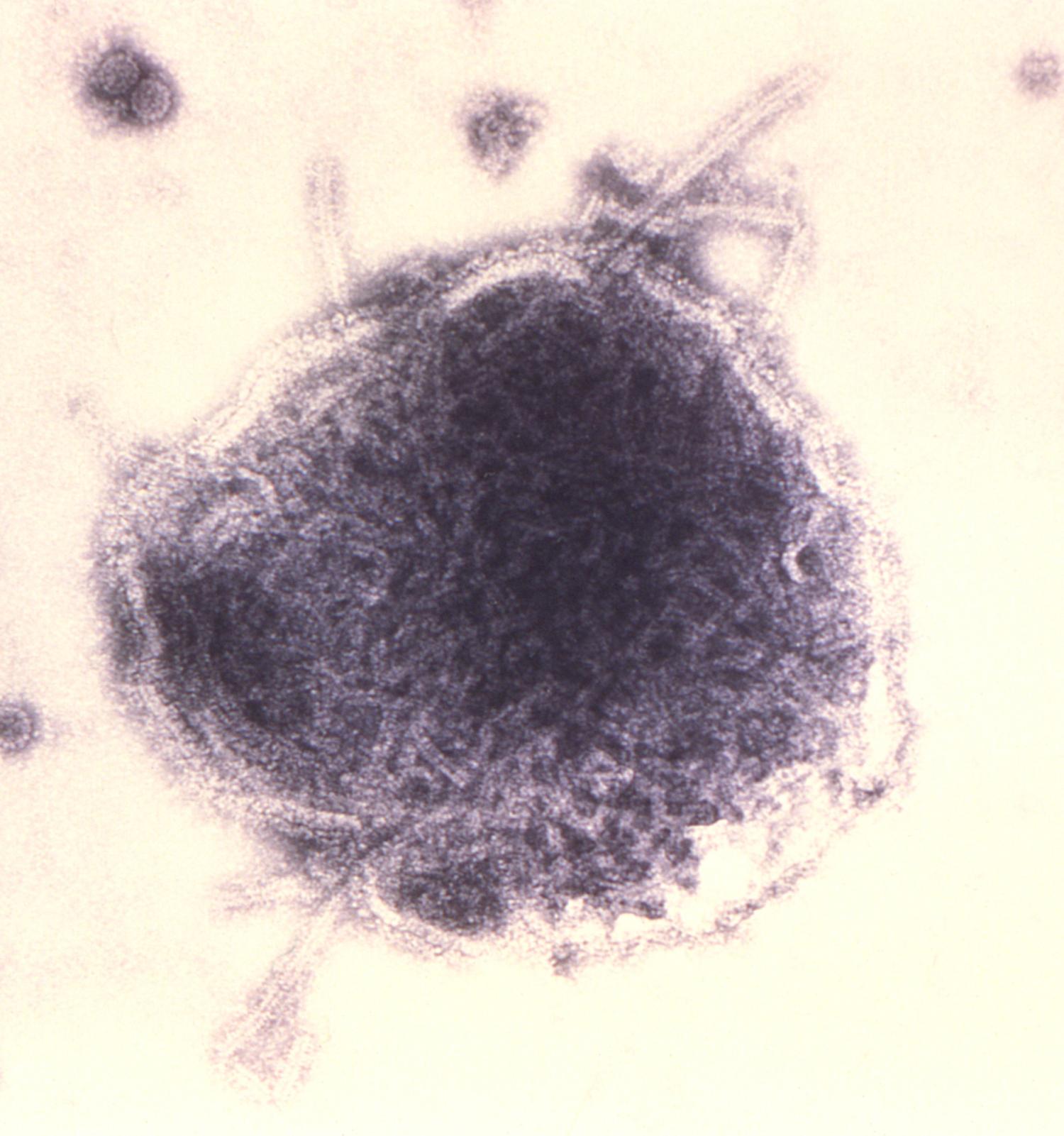 measles virus 