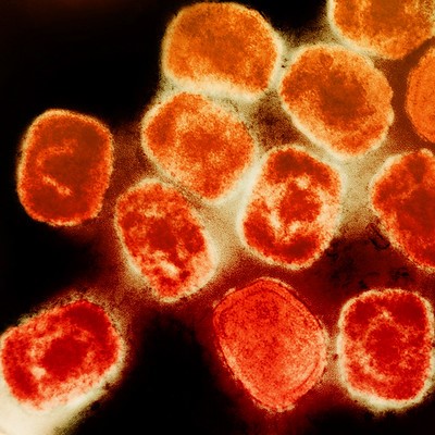 mpox viruses under the microscope