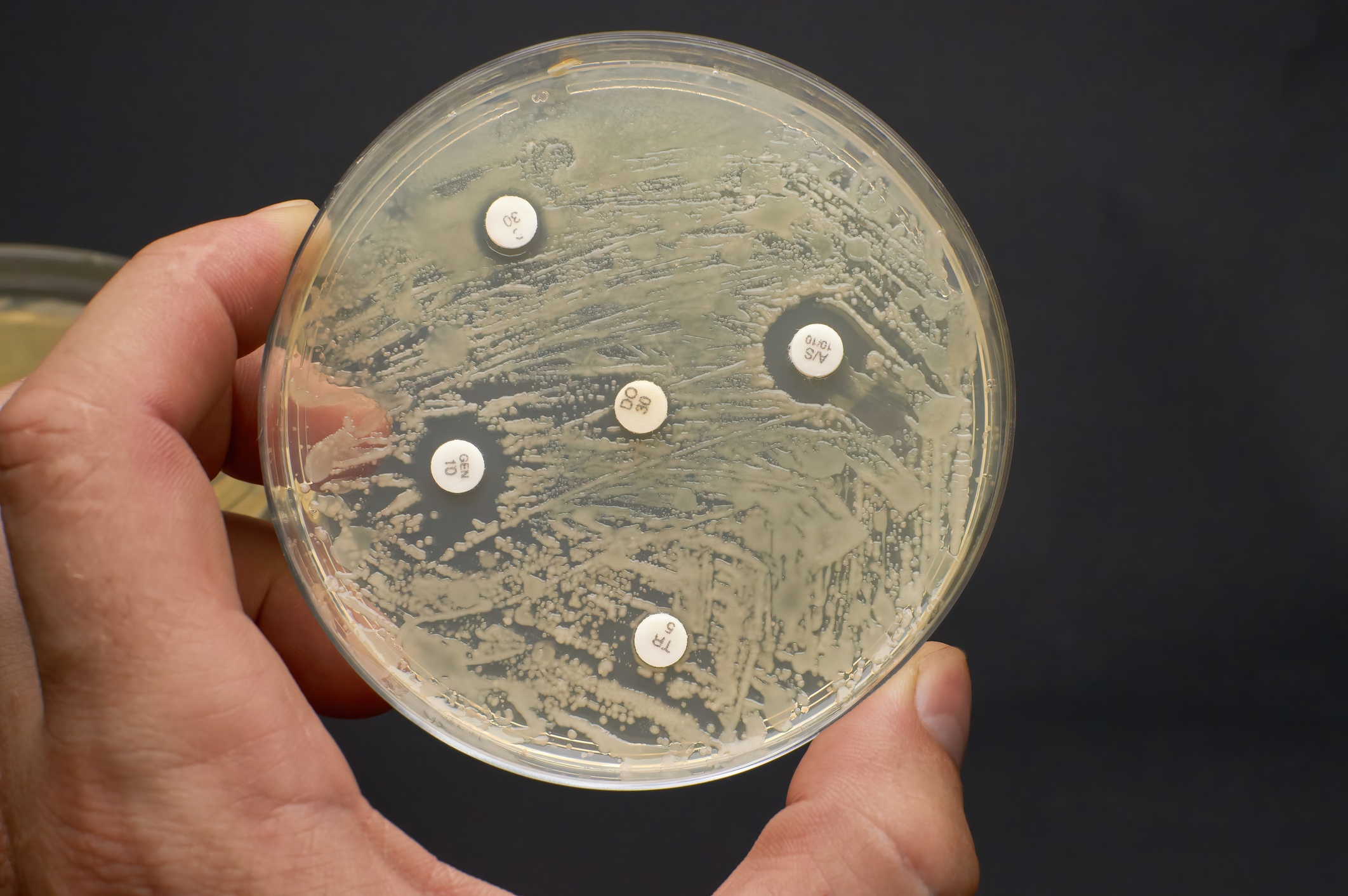 A hand holding a petri dish with multidrug-resistant bacteria