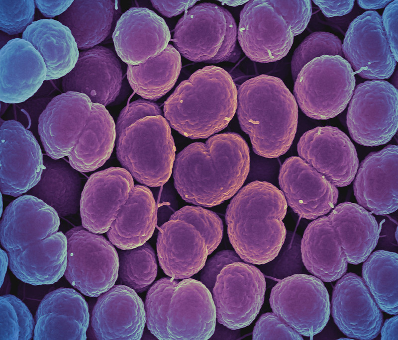 Neisseria gonorrhea