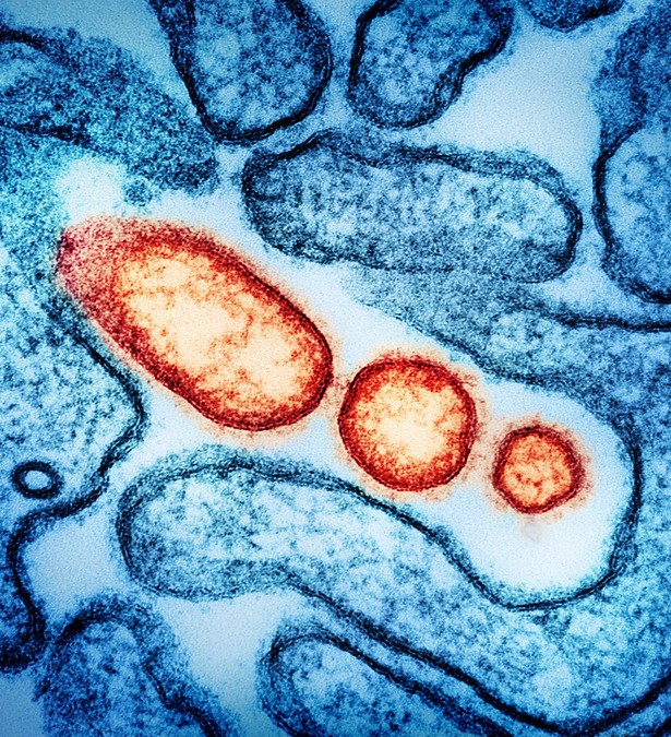 Nipah viruses