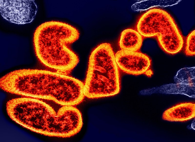 Nipah virus particles