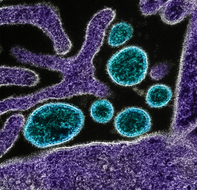 Nipah virus