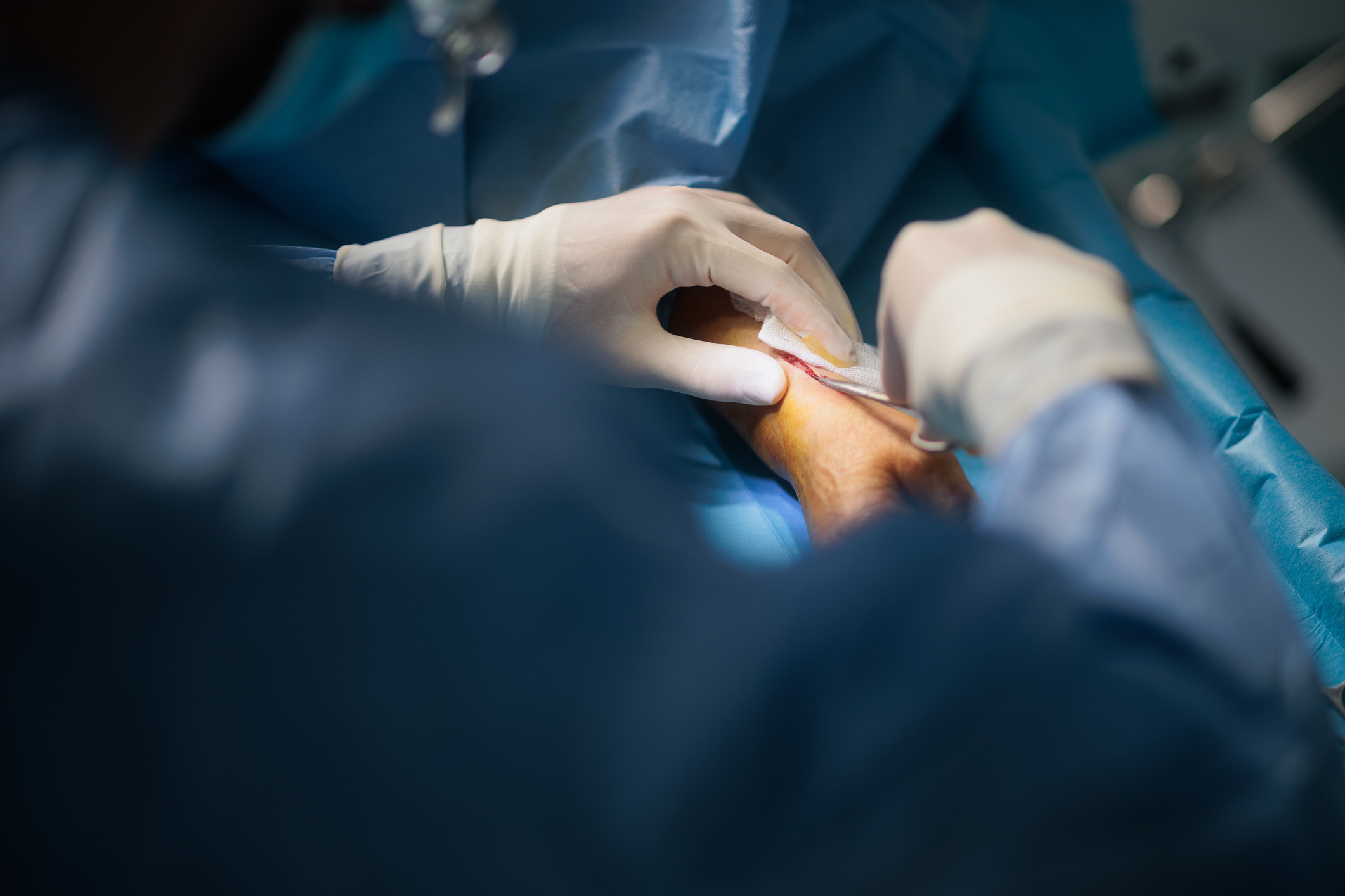 Surgeon with white gloves making an incision in patient's wrist