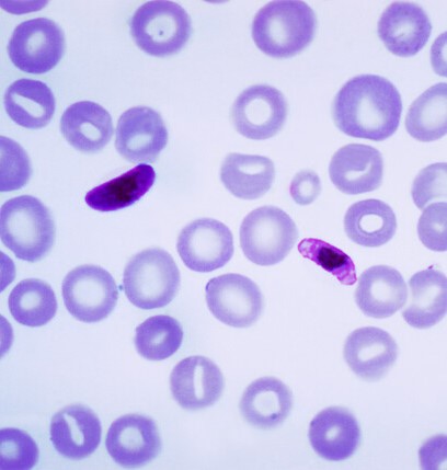 Plasmodium parasites