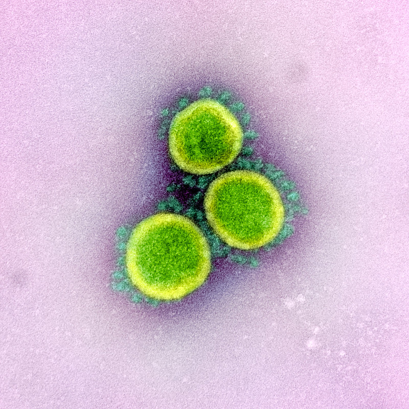 SARS-CoV-2 micrograph