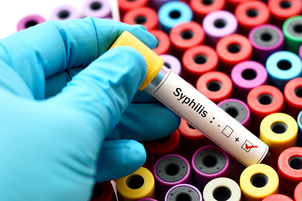 Syphilis test