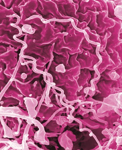Treponema pallidum bacteria, which cause syphilis